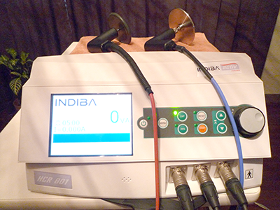 インディバ・アクティブ (自費診療)